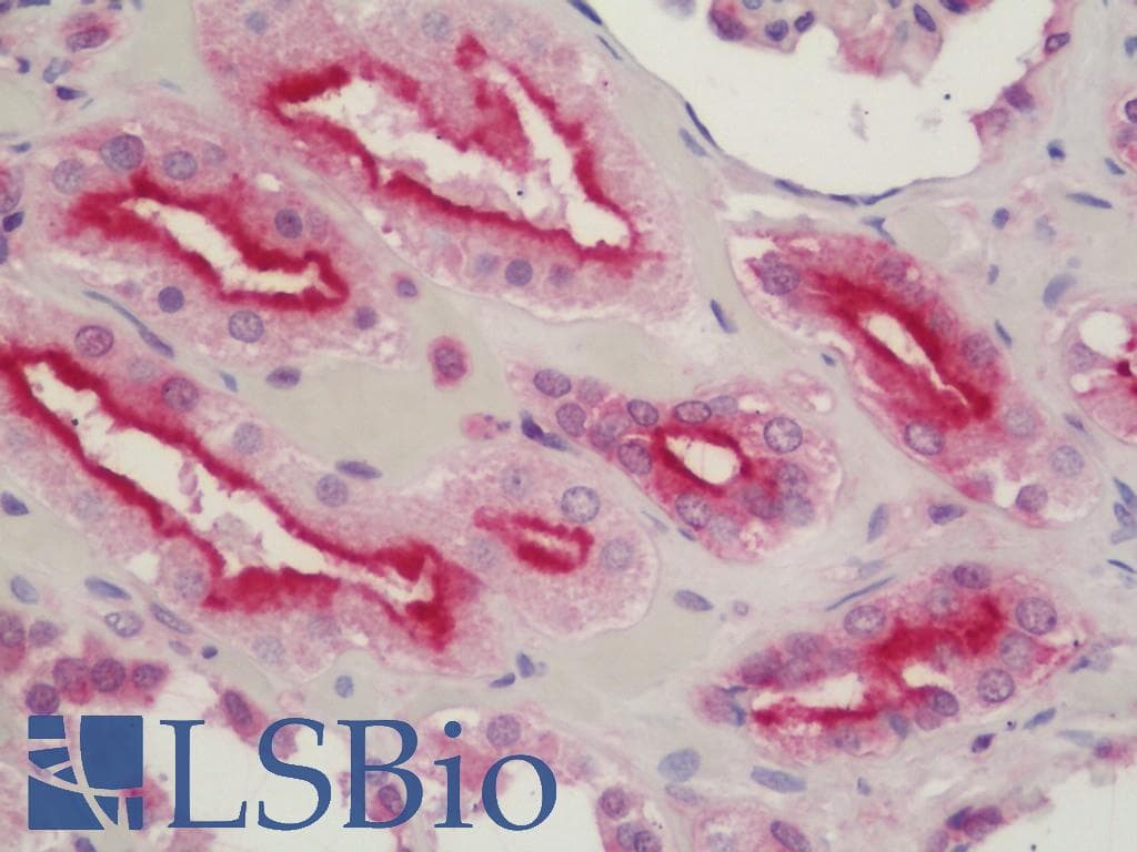 IHC-plus™ DHX15 Antibody (aa750-C-term)