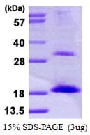 Human UBE2D3 / UBCH5C Protein (Recombinant His)