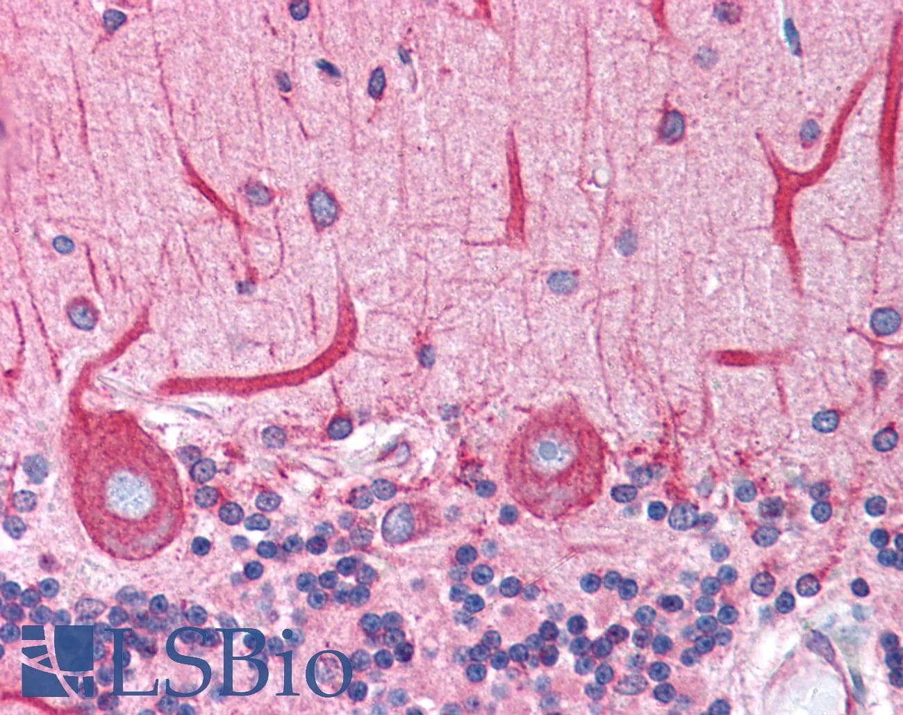 IHC-plus™ BCAP31 / BAP31 Antibody (aa301-313)