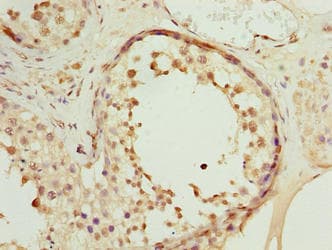 SPDL1 / CCDC99 Antibody