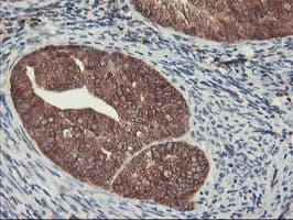 HES1 / HES-1 Antibody (clone OTI1B5, Carrier-free)
