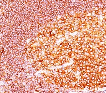 Monoclonal Mouse anti-Human MALT1 Antibody (clone MT1/410, Ready-to-Use, aa701-808, IHC)