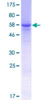 Human SMYD5 Protein (Recombinant GST)