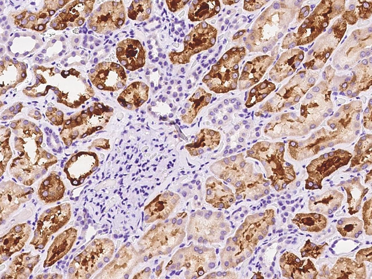 Polyclonal Rabbit anti-Human FIGNL1 Antibody (IHC, WB)