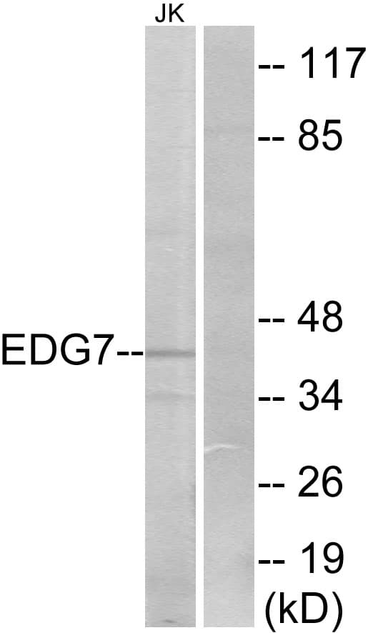 LPAR3 / LPA3 / EDG7 Antibody (aa111-160)