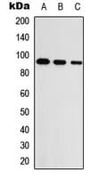 Polyclonal Rabbit anti-Human UNC5A Antibody (Internal, WB)