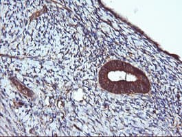 IHC-plus™ ACAA2 Antibody (clone 1C10)