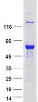 Human JMJD6 / PSR Protein (Recombinant Myc-DDK (Flag))