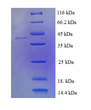 Human LIMD2 Protein (Recombinant GST)