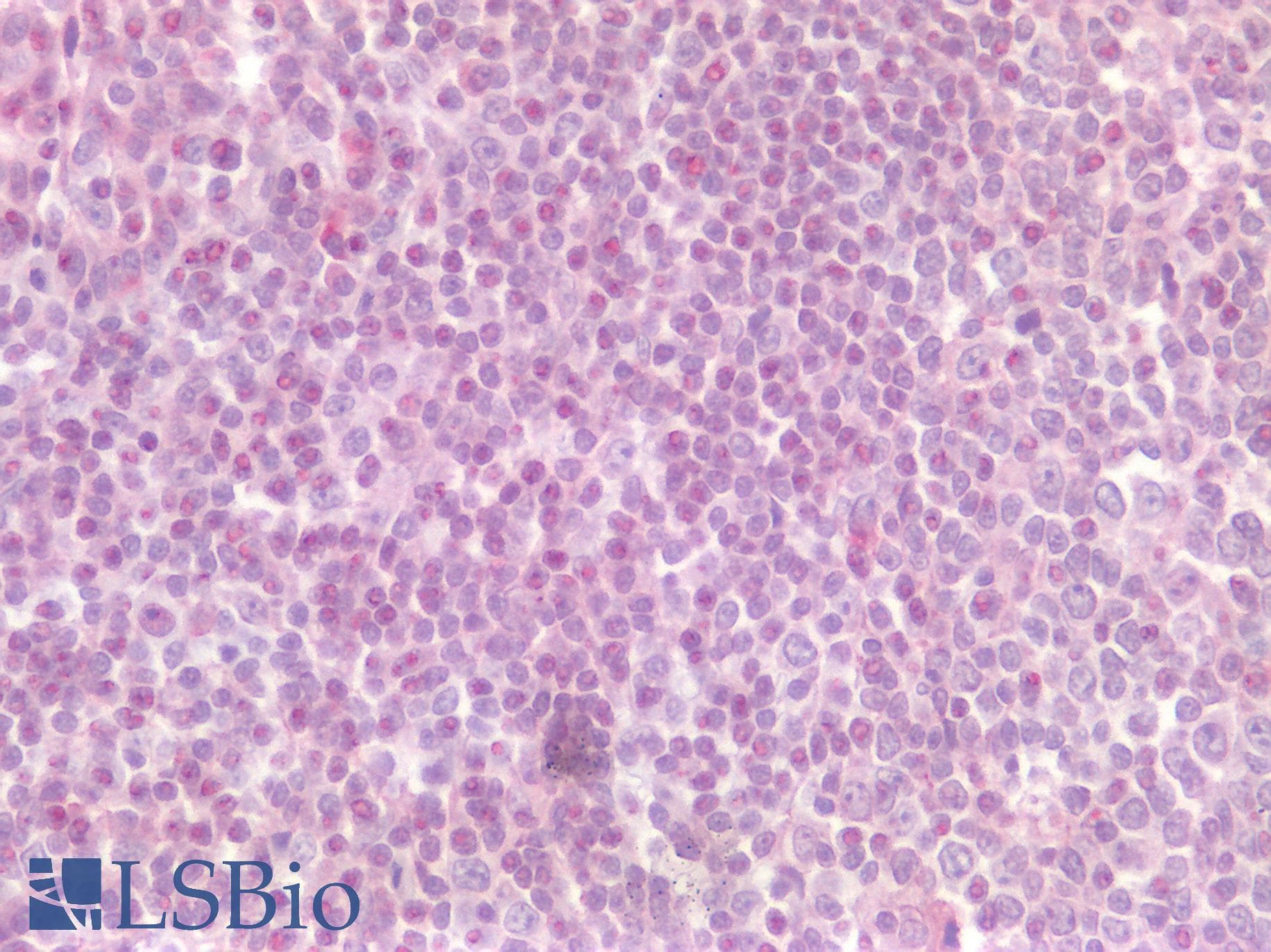 IHC-plus™ CD4 Antibody (Extracellular Domain)