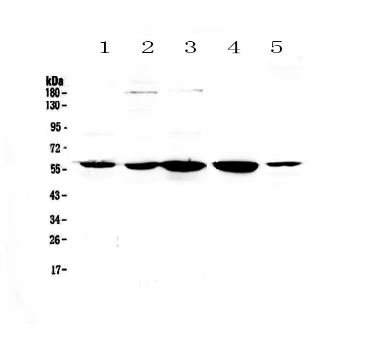 Polyclonal Rabbit anti-Human ETV6 / TEL Antibody (IHC, WB)