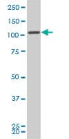 CCDC132 Antibody (clone 2D11)
