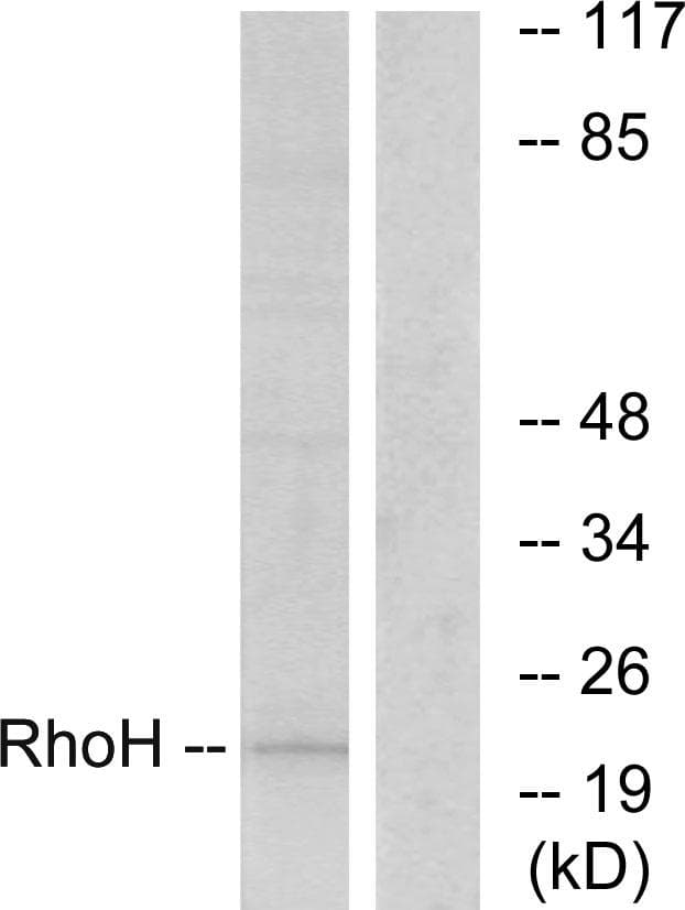 Polyclonal Rabbit anti-Human TTF / RHOH Antibody (IF, WB)