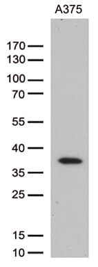 HOXD8 Antibody (aa69-290, clone OTI2A1, Carrier-free)