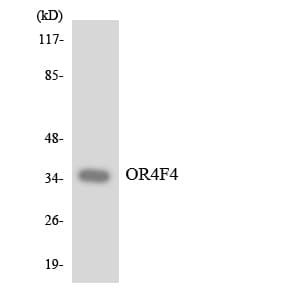 Polyclonal Rabbit anti-Human OR4F4 Antibody (aa249-298, WB)