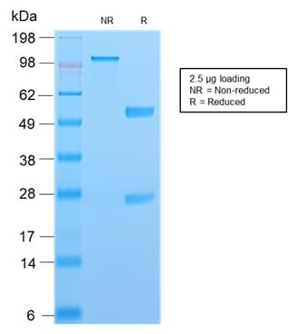 S100A4 / FSP1 Antibody (aa1-200, clone S100A4/2750R)