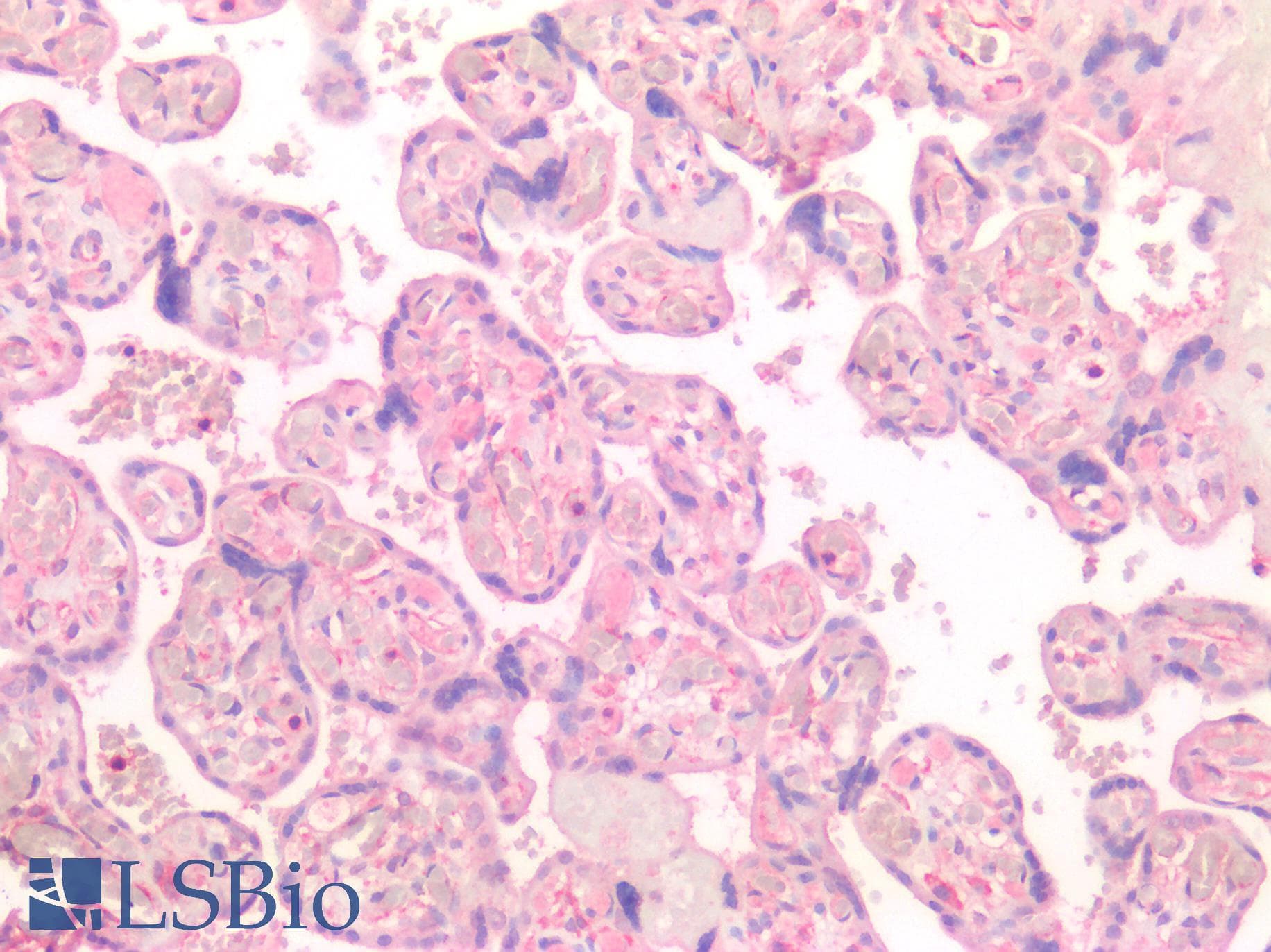 IHC-plus™ CTSK / Cathepsin K Antibody