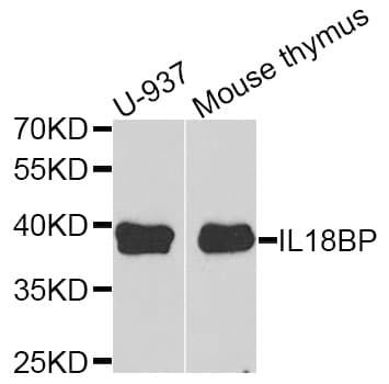 Polyclonal Rabbit anti-Human IL18BP Antibody (IHC, IF, WB)
