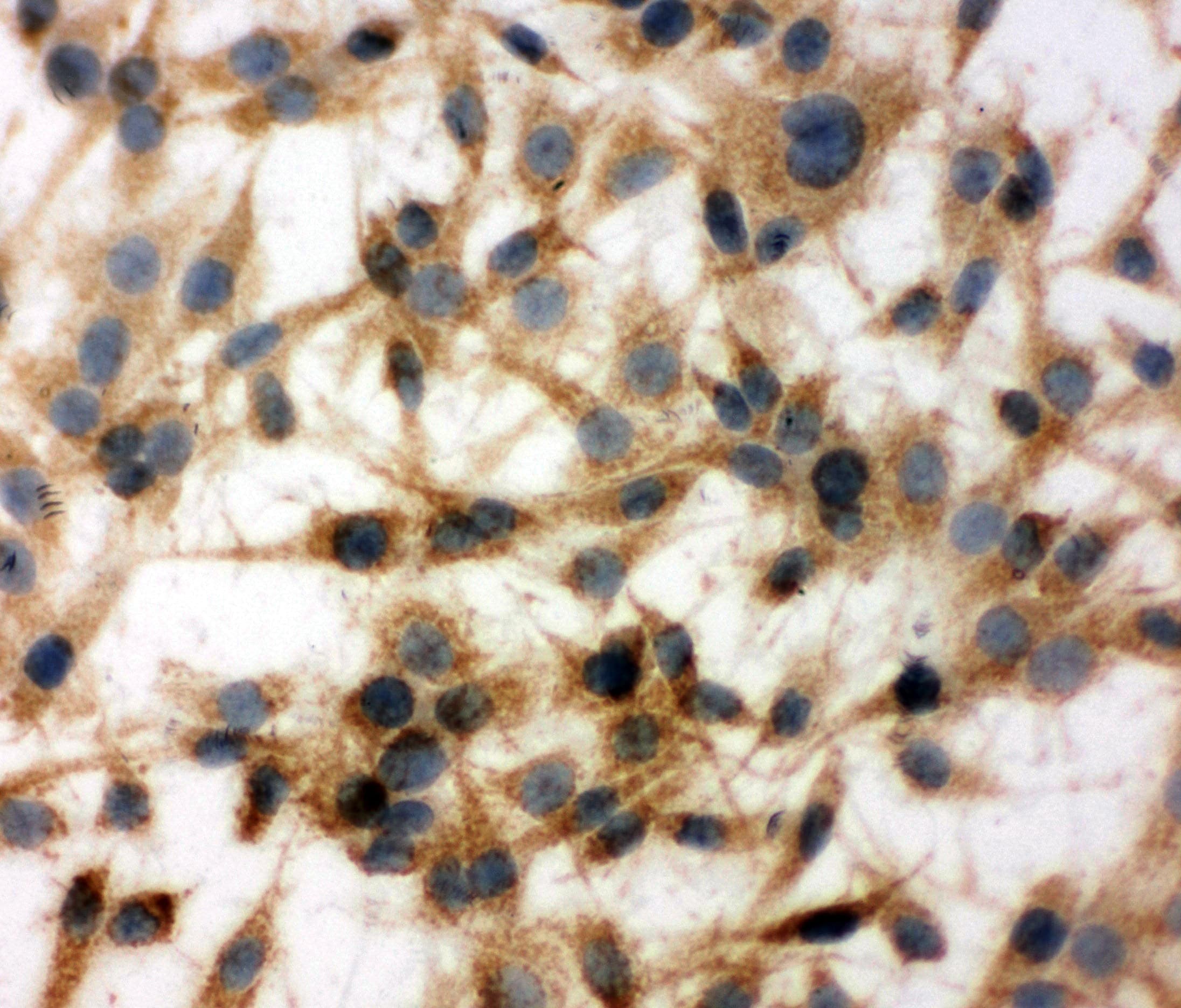 Polyclonal Rabbit anti-Human MT-CO1 / COX1 Antibody (aa501-514, IHC, WB)