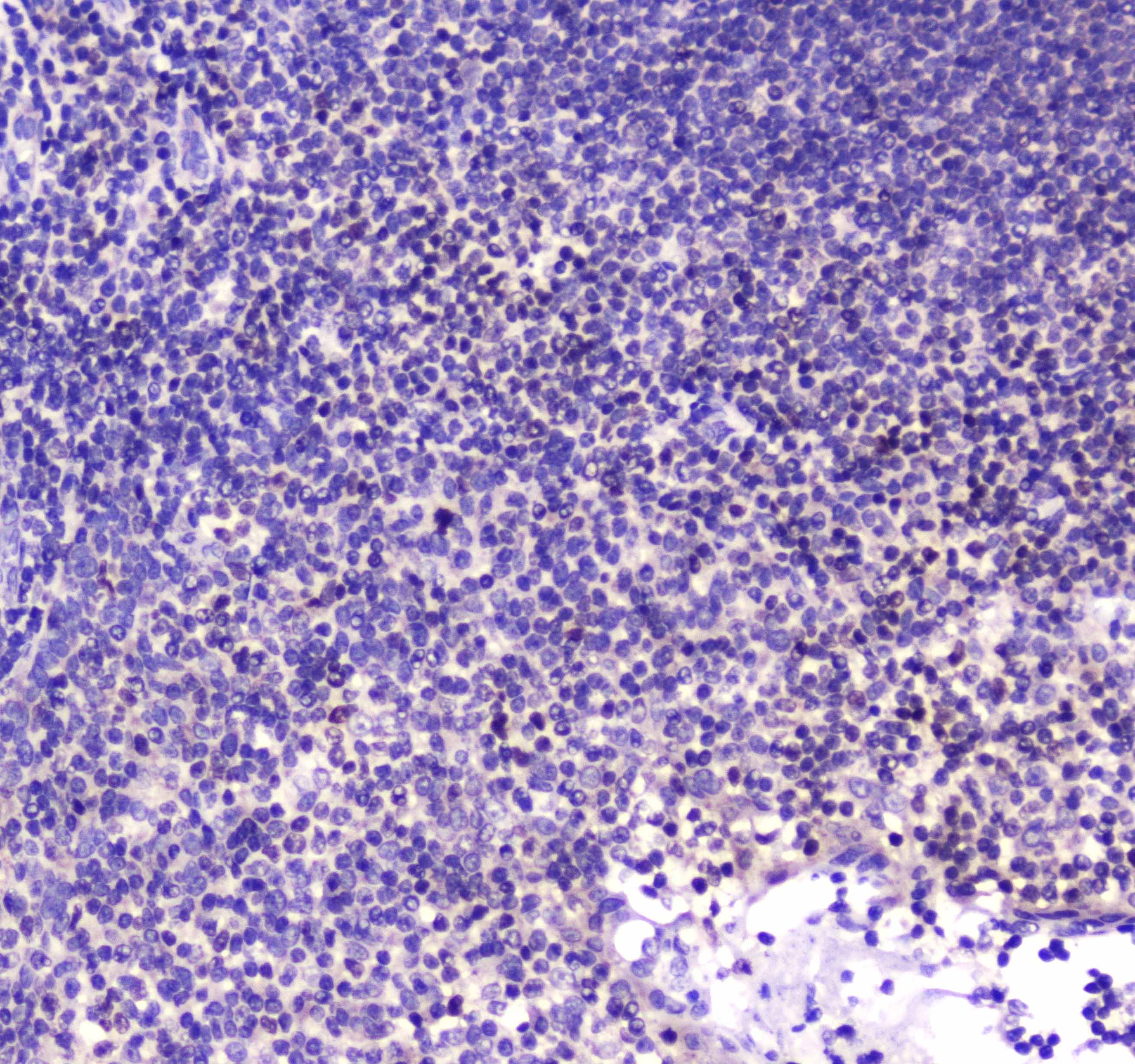 CBFB Antibody