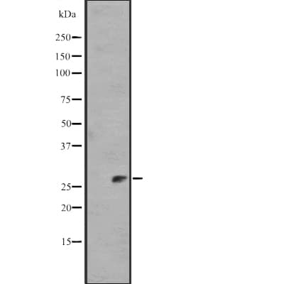 Polyclonal Rabbit anti-Human IL11 Antibody (WB)
