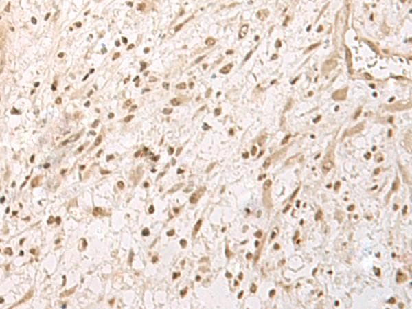 Polyclonal Rabbit anti-Human RRP1 Antibody (IHC, WB)