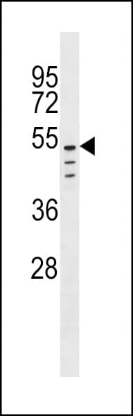 CLEC18C Antibody (aa300-326)