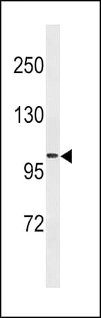 Monoclonal Mouse anti-Human FGA / Fibrinogen Alpha Antibody (aa420-448, WB)