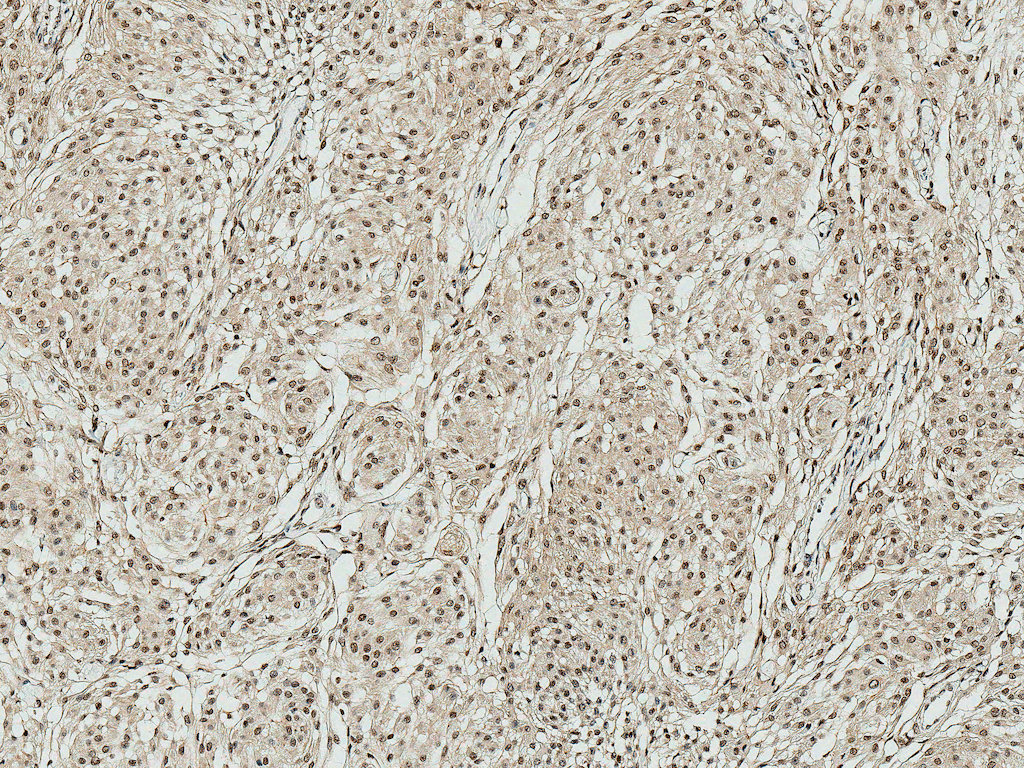 Apg7 / ATG7 Antibody (APC)