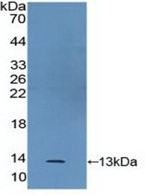 S100A2 Antibody (aa529-615, HRP)