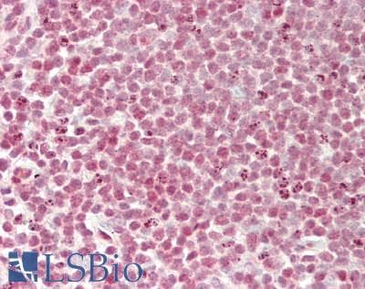 IHC-plus™ MGMT Antibody