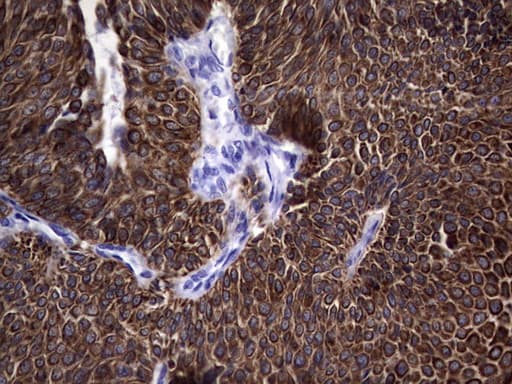 KRT19 / CK19 / Cytokeratin 19 Antibody (aa240-390, clone OTI5G7)