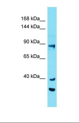 Polyclonal Rabbit anti-Human EFR3A Antibody (aa736-785, WB)