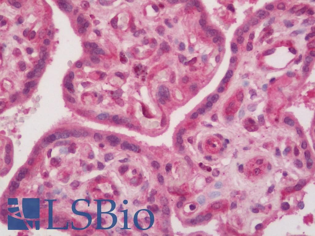 IHC-plus™ Polyclonal Rabbit anti-Human ADORA2B/Adenosine A2B Receptor Antibody (IHC, IF, WB)
