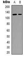 SCAF4 Antibody (Internal)