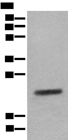 Polyclonal Rabbit anti-Human CRYGS Antibody (WB)