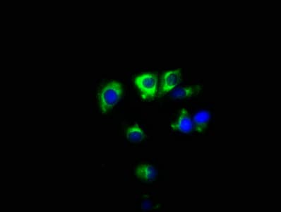 Polyclonal Rabbit anti-Human SYNPR / Synaptoporin Antibody (WB)