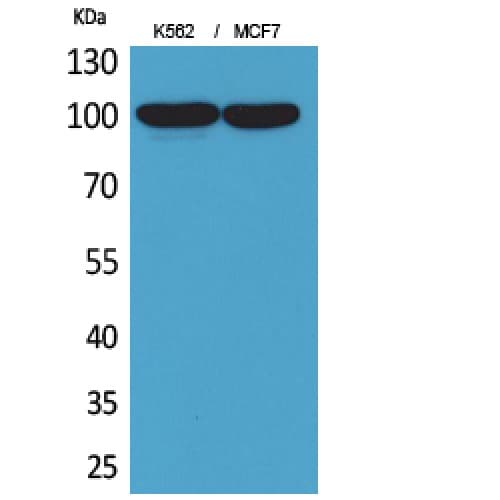 ENPP3 / CD203c Antibody (270-320 aa, Internal)
