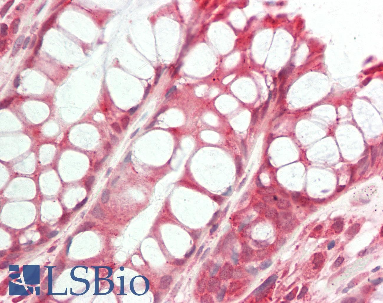 IHC-plus™ GOK / STIM1 Antibody (C-Terminus)
