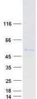 Human CYP2A7 Protein (Recombinant Myc-DDK (Flag))