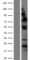 ZHX1 Protein (Over-Expression Lysate Myc-DDK (Flag))