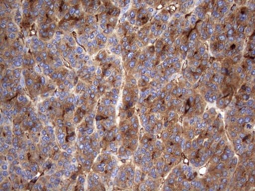 Monoclonal Mouse anti-Human TG / Thyroglobulin Antibody (clone OTI8A8, aa20-358, IHC, WB)