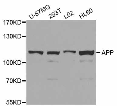 APP / Beta Amyloid Precursor Antibody