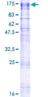 Human TMEM63A Protein (Recombinant GST)