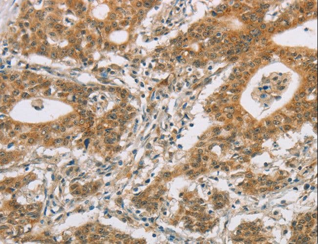 Polyclonal Rabbit anti-Human P450SCC / CYP11A1 Antibody (IHC)