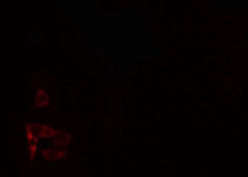 PTX3 / Pentraxin 3 Antibody