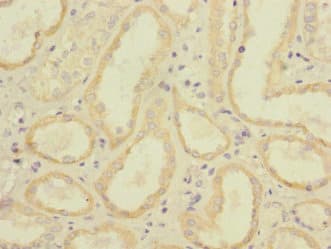 Polyclonal Rabbit anti-Human CD32C Antibody (IHC, WB)