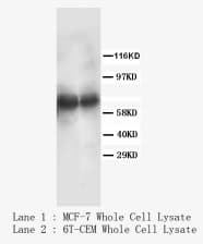 HGF / Hepatocyte Growth Factor Antibody (N-Terminus, Sepharose)