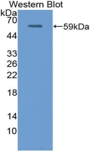 UMOD / Uromodulin Antibody (aa335-590, FITC)