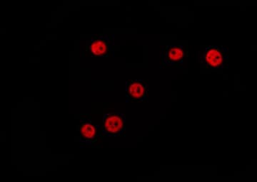 NIRF / UHRF2 Antibody
